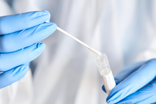 Tupfer für Speichelprobe