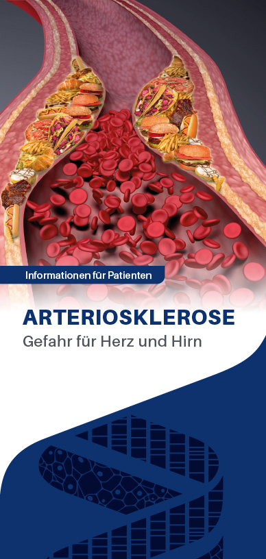 1315 0065 Ateriosklerose